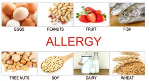 common allergies in kids